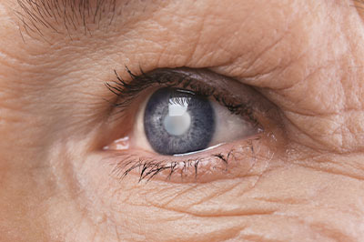 Cross River Eye Care | Contact Lens Exams, Glaucoma Management and Optical Department